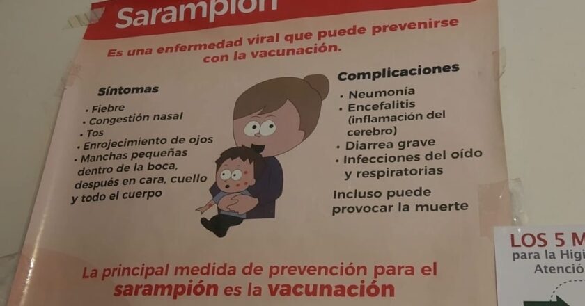 ¡Era varicela!, descartan casos de sarampión en primaria de SLP